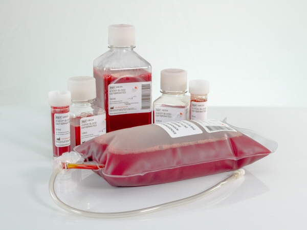 Animal Blood Products - TCS Biosciences